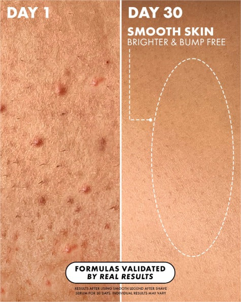 Serum para despues del Afeitado