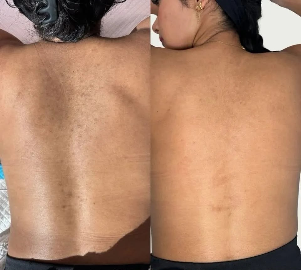 Dr Melaxin Peel Shot Exfoliating