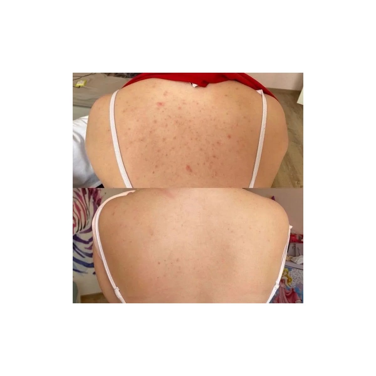 Dr Melaxin Peel Shot Exfoliating